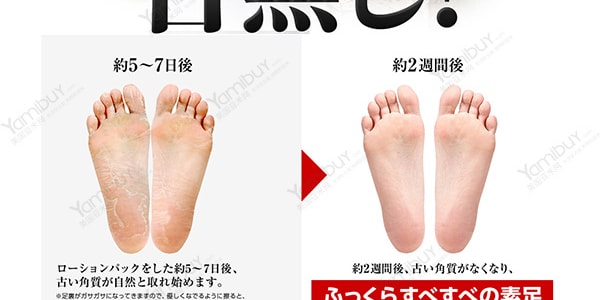 日本ASHIURA 快速去角质足膜脚膜 1对入 突破100万销量