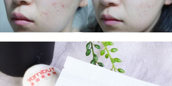 韓國COSRX珂絲艾絲 專效淨痘隱形貼 吸附療癒晚貼 夜間痘痘貼 24貼入